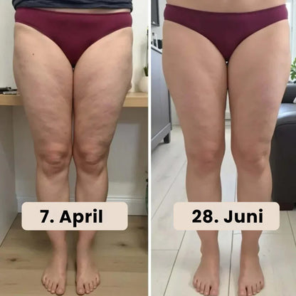Seamless Anti-Cellulite Leggings