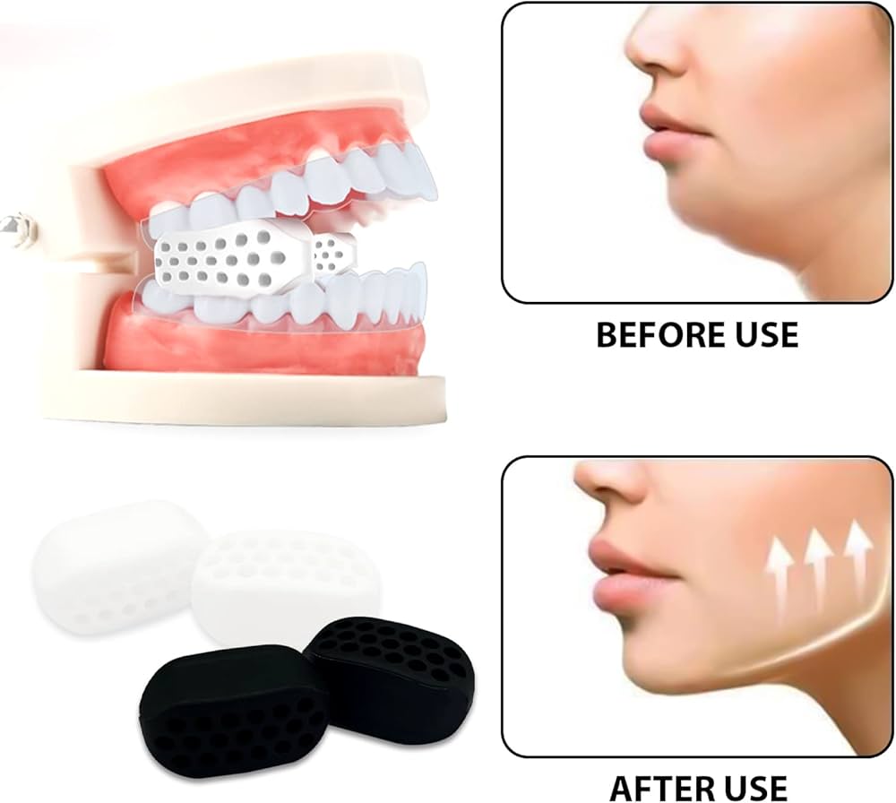 Ironfit Jaw Trainer